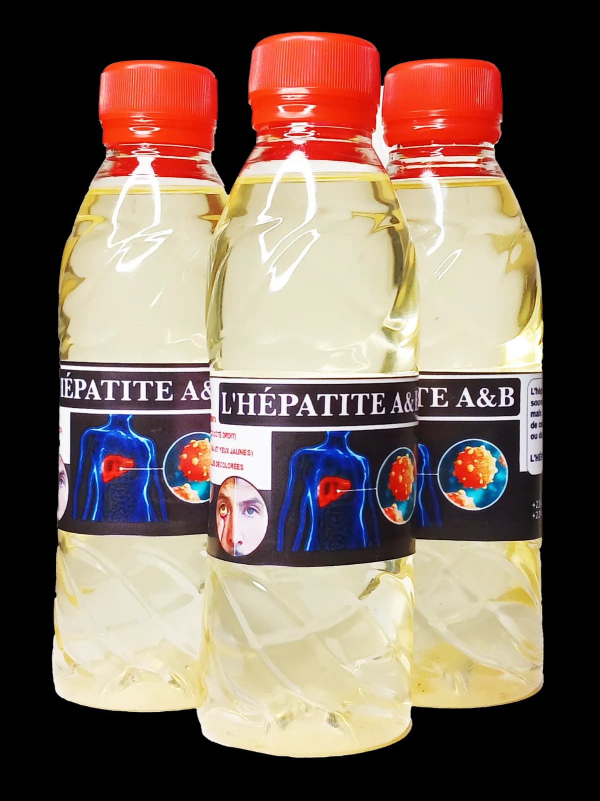 L’Hépatite A & B