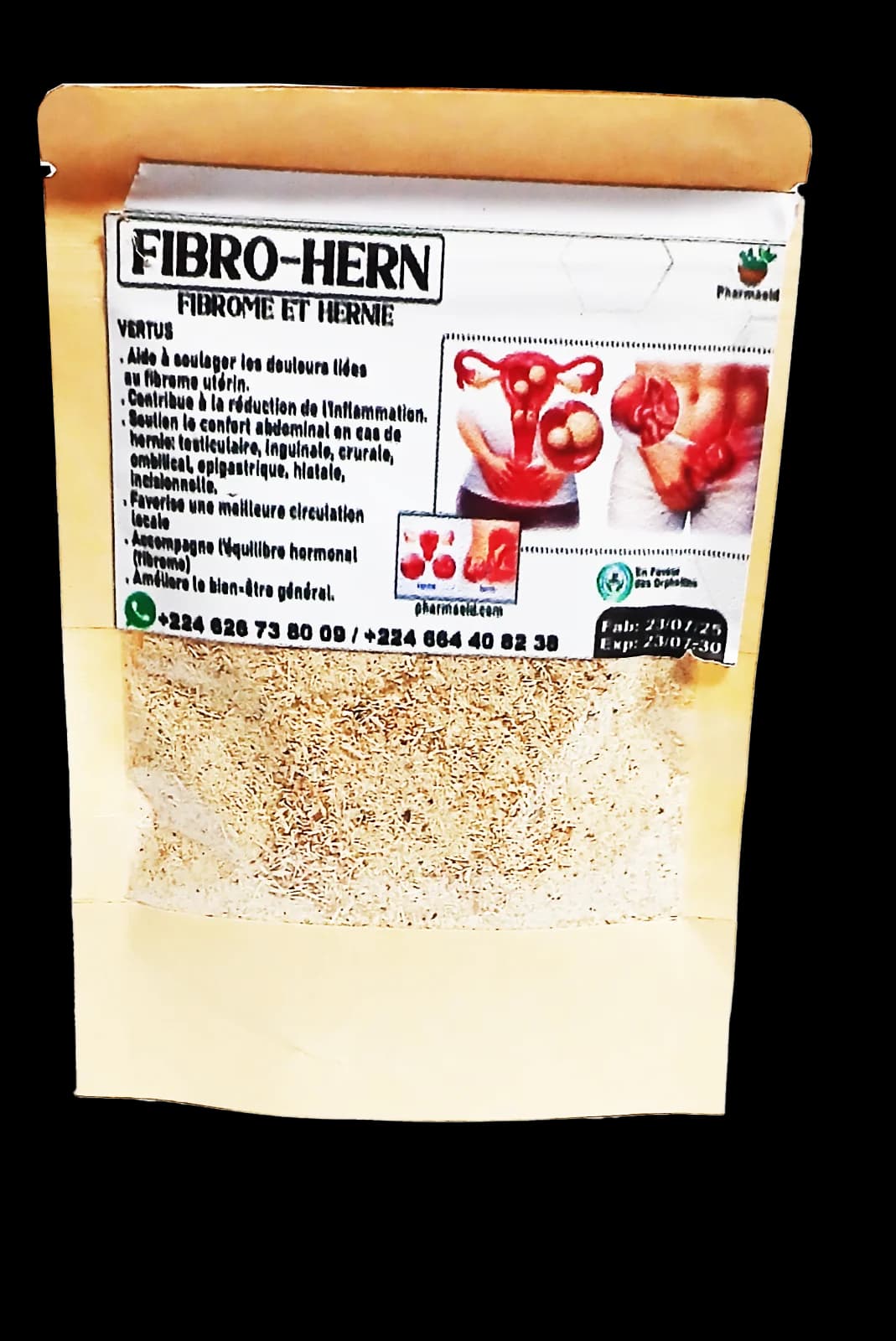 Fibro-Hern, fibrome et hernie