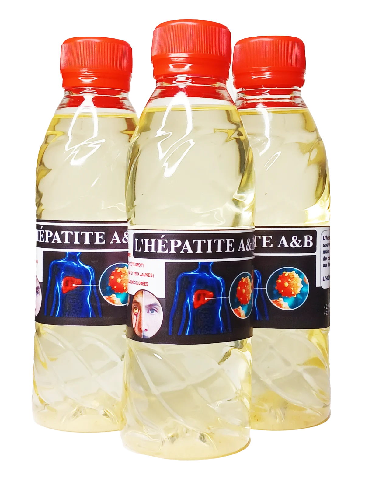 L’Hépatite A & B