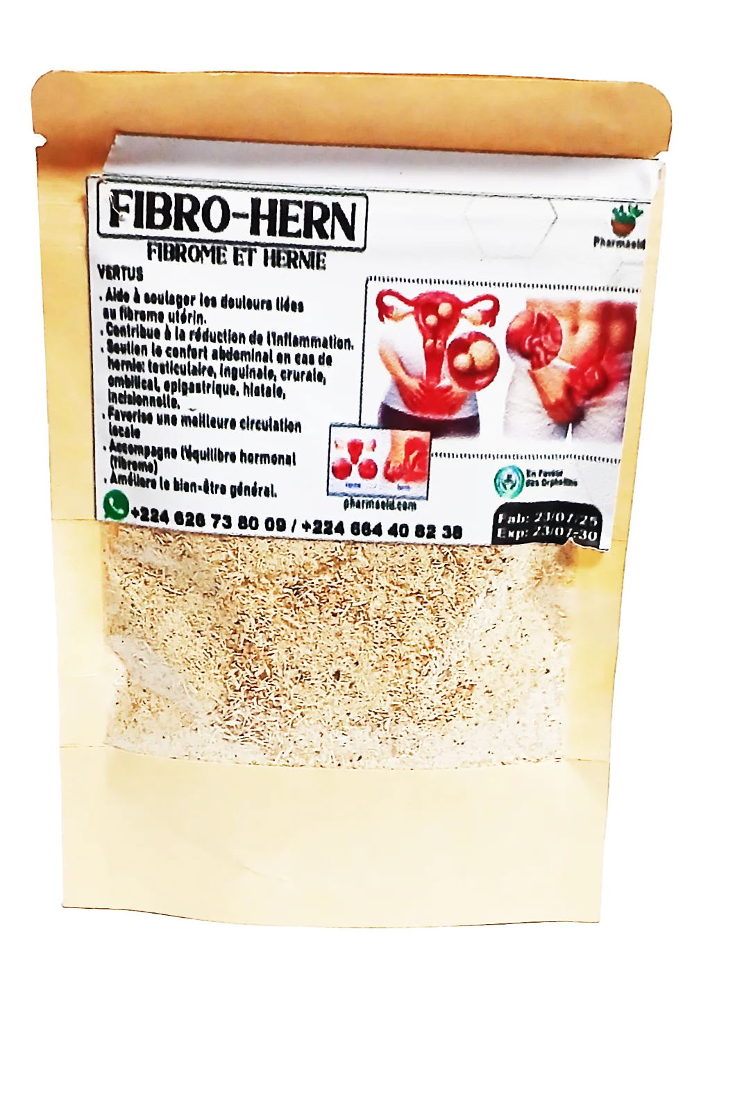 Fibro-Hern, fibrome et hernie